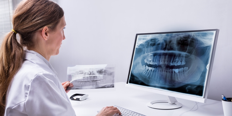 TC Cone Beam: tecnologia sofisticata per il distretto maxillo-facciale