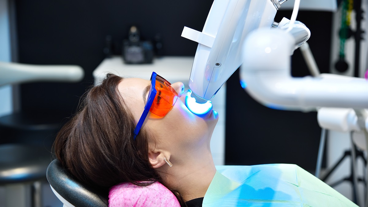 Igiene ed estetica dentale: lo sbiancamento