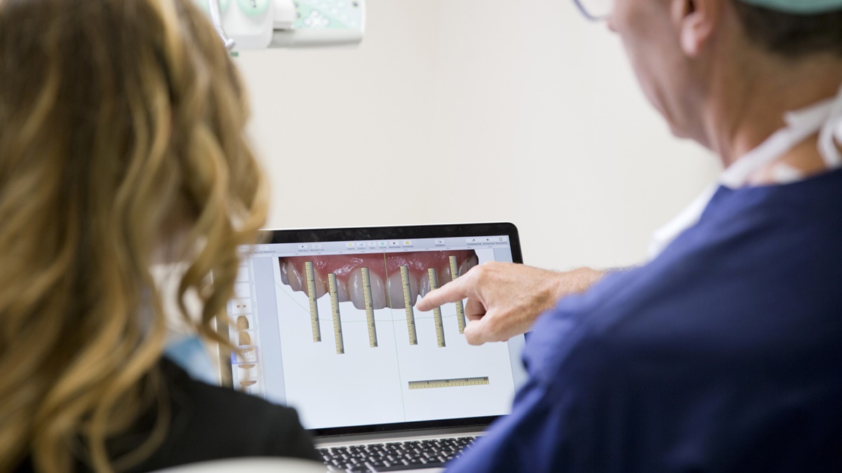 Eseguire un impianto dentale senza intervento chirurgico