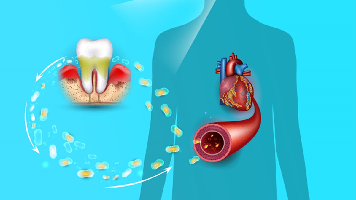 Le gengive e il cuore