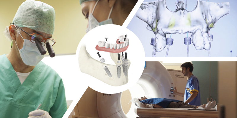Implantologia a carico immediato alla Dental Unit di Maria Cecilia Hospital e del Primus Medical Center