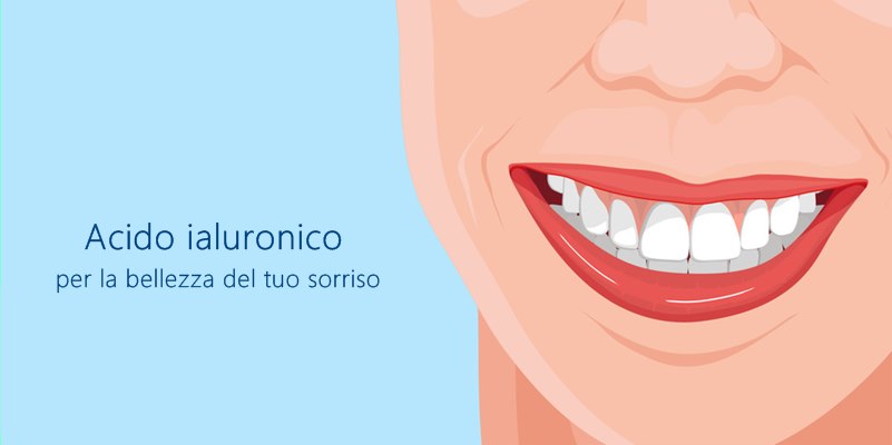 Acido ialuronico per una perfetta estetica dentale