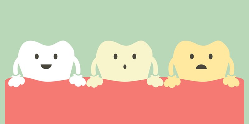 Il sorriso torna a splendere con lo sbiancamento dentale