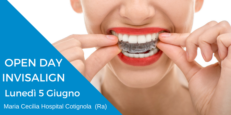 Open Day Invisalign: Lunedì 5 Giugno 