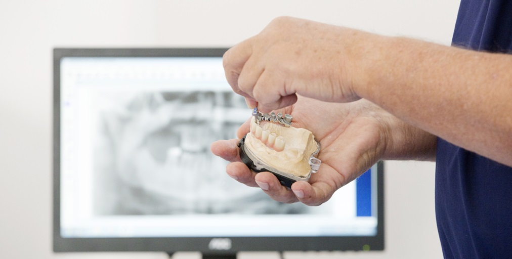 A Villa Lucia Hospital eseguito un impianto dentale a carico immediato su paziente cardiopatico