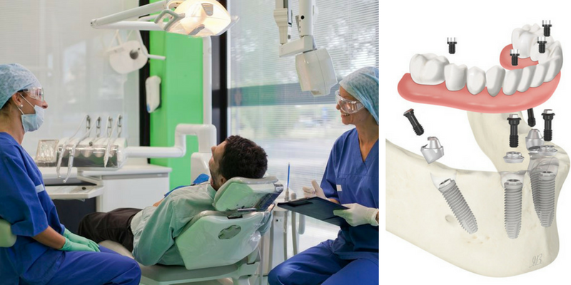 Un’implantologia nel rispetto del paziente